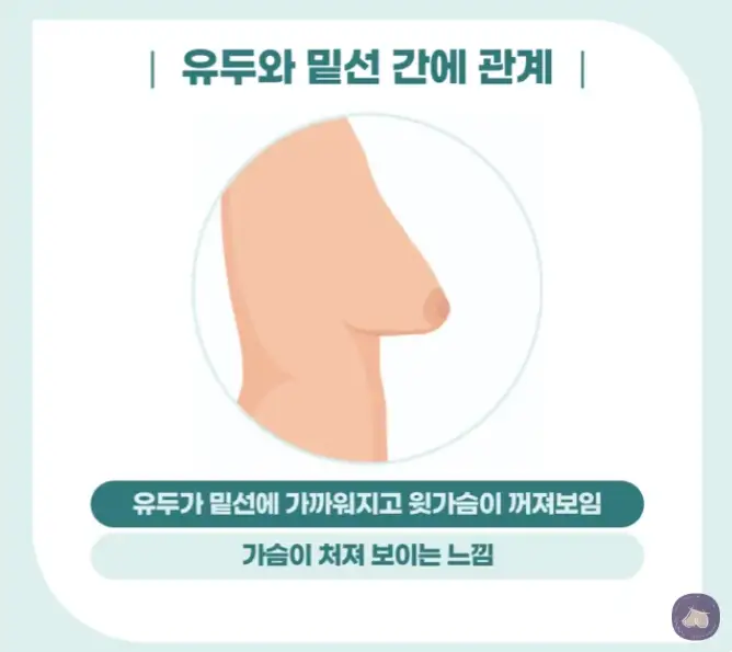 가슴거상술비용, 가격? 작년 가슴 보형물 성형만 3023건 한 곳에서 말씀드립니다. — 본문 이미지 5