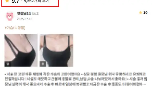 가슴보형물제거후기? 2편의 논문으로 알아보는 모양/신체 변화 — 본문 이미지 10