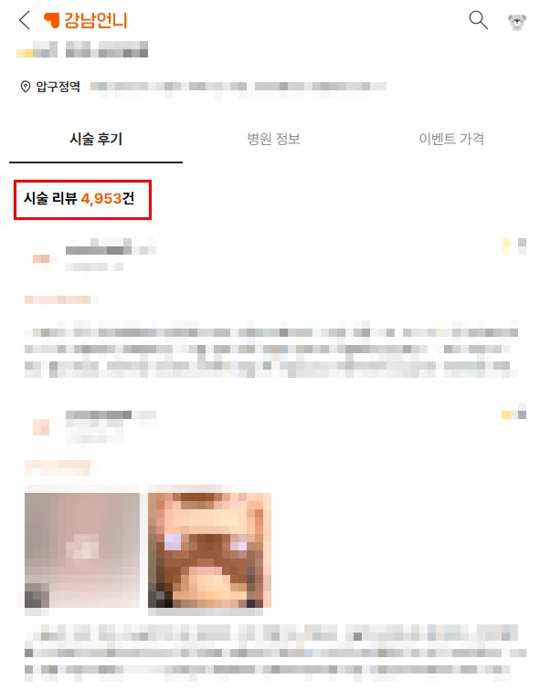 가슴재수술시기, 옆빠짐/윗볼록 부작용 주의사항