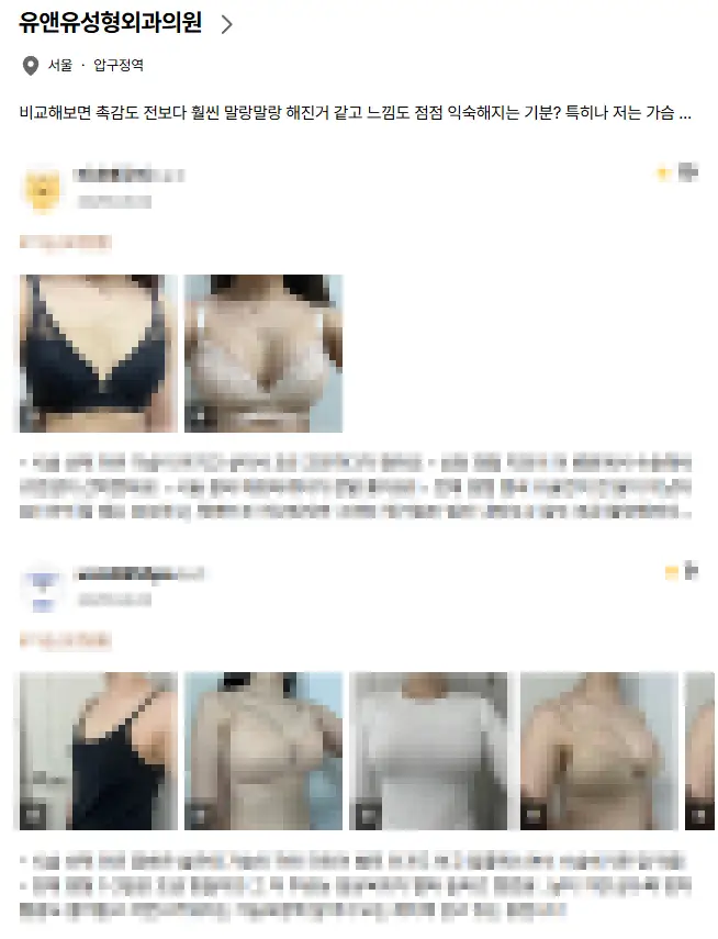 가슴성형잘하는곳? 확인할 기준 2가지 <2000년부터 연구해온 경험으로 드리는 조언> — 본문 이미지 14