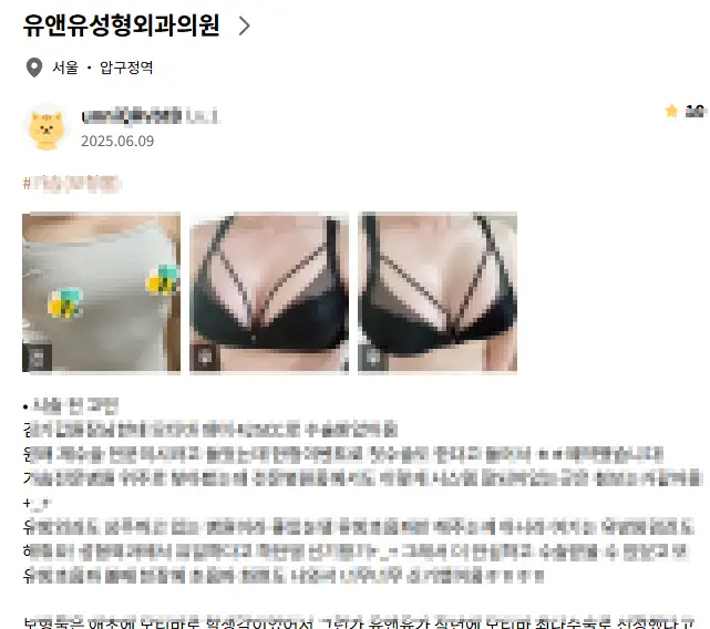 가슴성형마취, 수면/전신? 정말 안전할까 — 본문 이미지 1