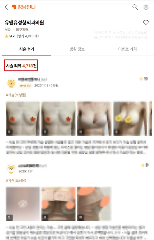 가슴성형후브라, 얼마나 착용하고 있어야 할까? <윗밴드까지 자체 개발하는 성형외과에서 드리는 조언> — 본문 이미지 3