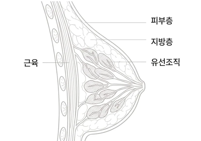 압구정가슴성형, 후기 많은 곳=잘하는 곳이라는 착각?<20년간 가슴성형만 연구한 곳 작성> — 본문 이미지 5