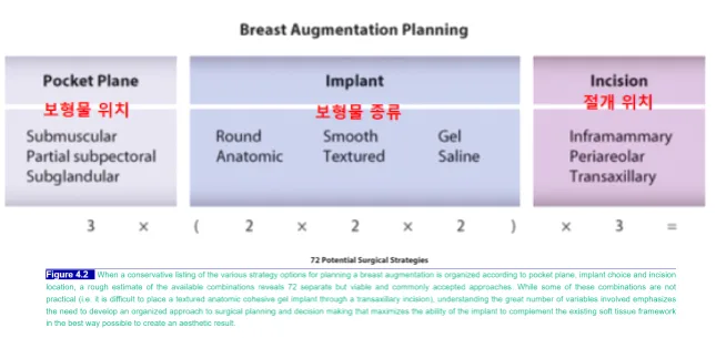 이미지 출처 : https://plasticsurgerykey.com/breast-augmentation-4/