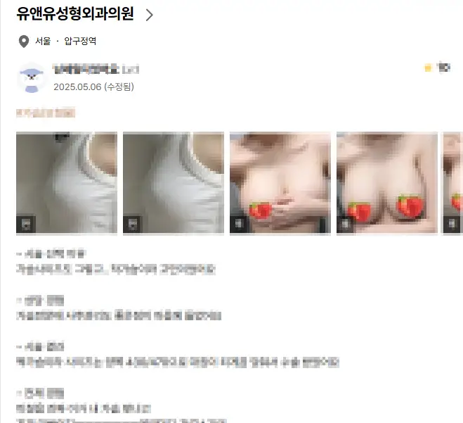 가슴비대칭, 성형하면 맞출 수 있을까? <20년의 연구 경험으로 드리는 조언> — 본문 이미지 1