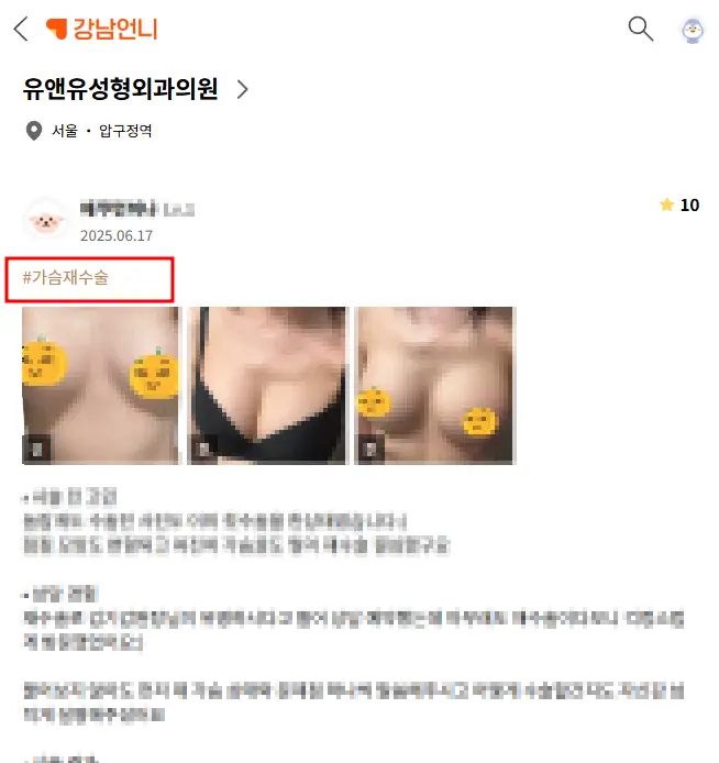 20여년 전부터 가슴성형만을 연구해온 기록들