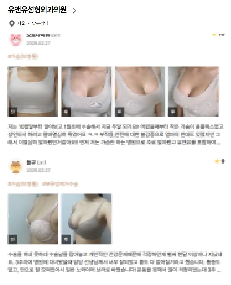 가슴성형비용, 비싸다고 무조건 좋을 거라는 착각? — 본문 이미지 6