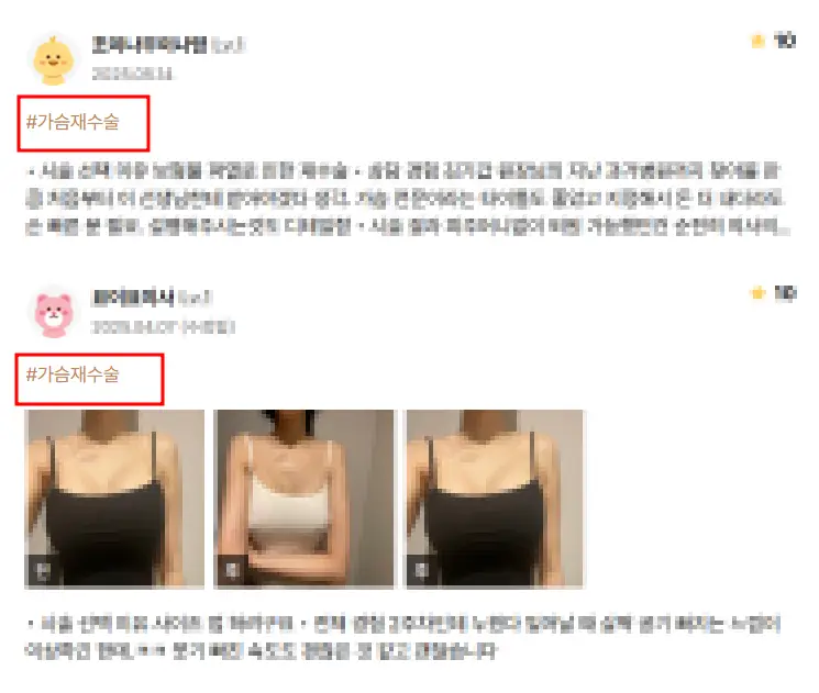 가슴수술구형구축, 실제 논문으로 보는 재수술 후기 — 본문 이미지 9