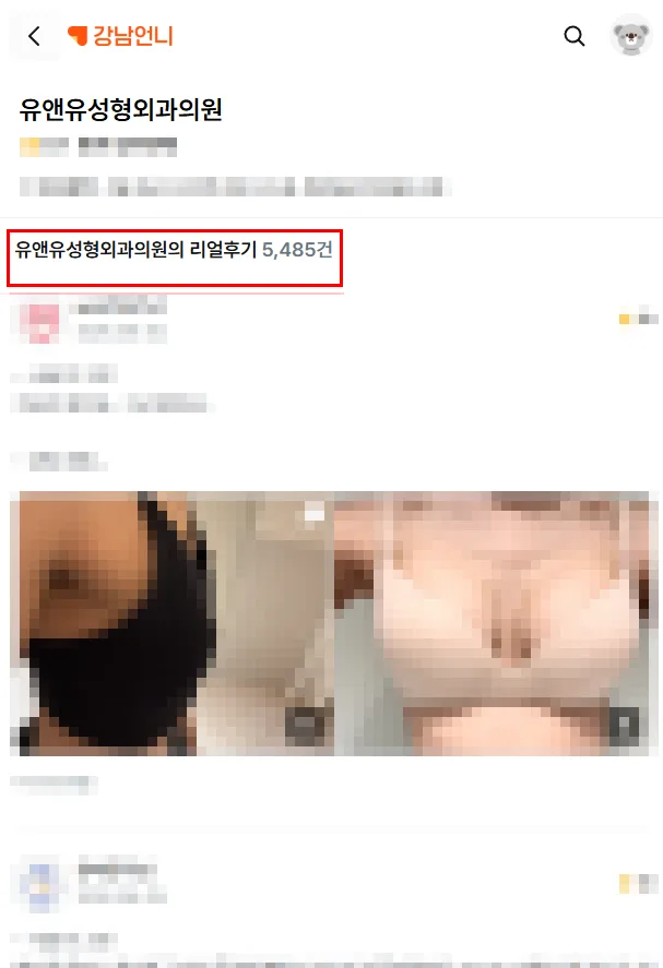 가슴성형외과추천? 후기 대신 '기록'을 보라고 말씀드리는 이유