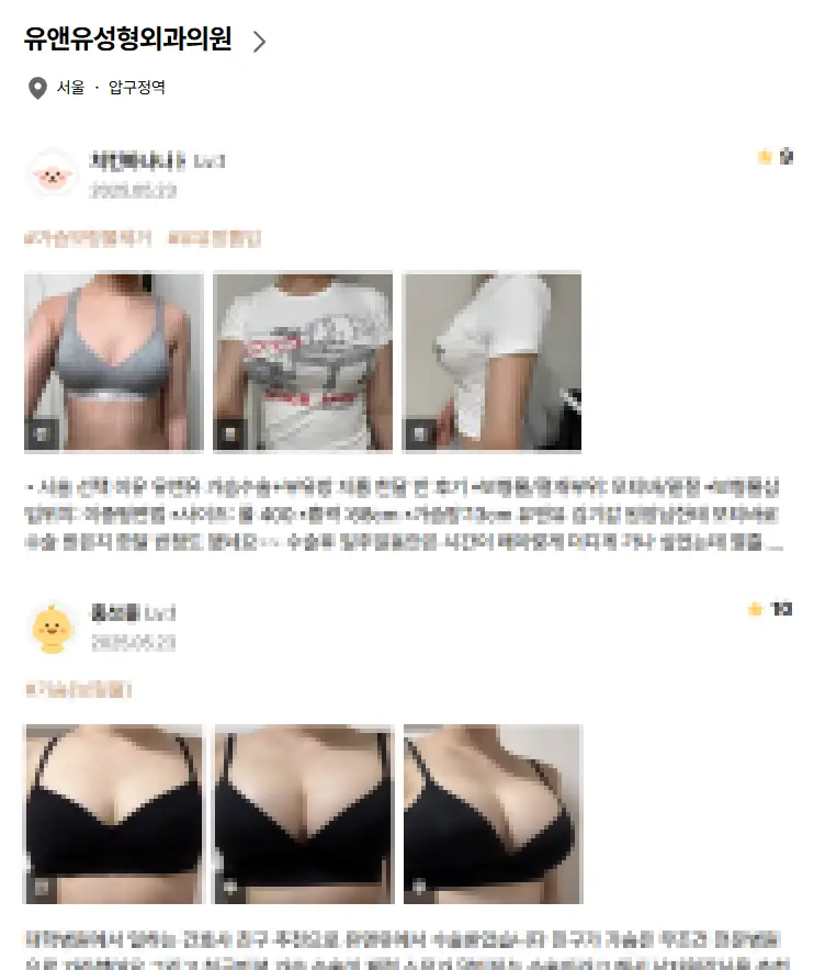 2000년대부터 가슴성형만을 연구해온 기록들