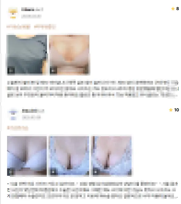 가슴수술사이즈? 병원에서는 이런 기준으로 권합니다. <20년 연구경험> — 본문 이미지 9