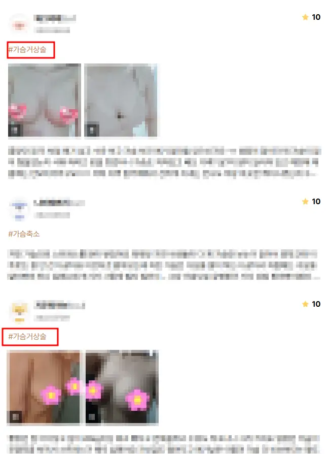 처진가슴수술비용, 거상술 / 보형물이 필요한 경우도 정리해드리겠습니다. <20년의 연구경험으로 드리는 조언> — 본문 이미지 9