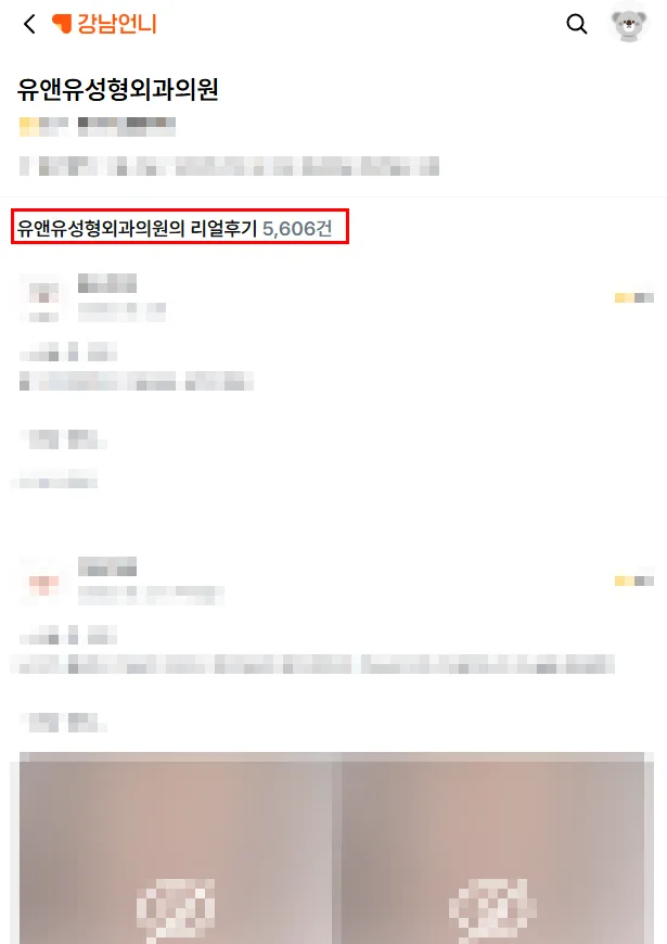 가슴구축증상, 무조건 재수술 해야할까?