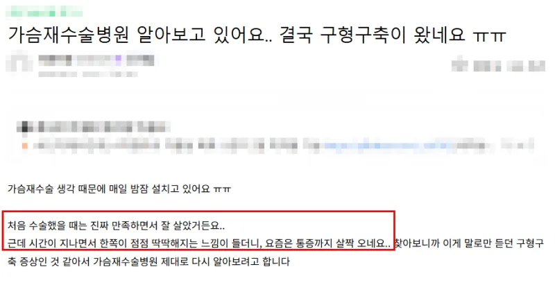 가슴성형외과, 부작용 피하기 위한 4가지 주의사항 <20년 가슴성형 연구한 의료진 작성> — 본문 이미지 1