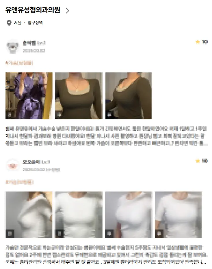 가슴성형비용, 비싸다고 무조건 좋을 거라는 착각? — 본문 이미지 8