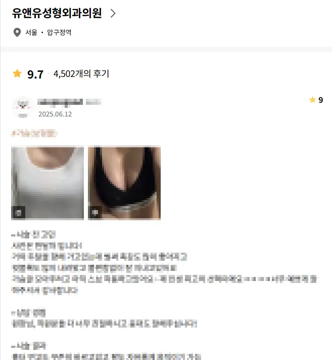 원데이가슴성형, 일반 수술에 비해 위험하진 않을까? <20년의 연구 경험으로 드리는 조언> — 본문 이미지 2