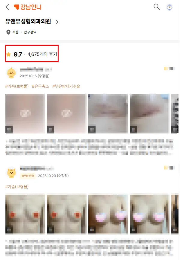 모티바가슴성형가격, 왜 다른 보형물보다 몇백만원씩 비쌀까? — 본문 이미지 4