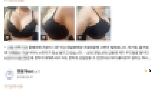 가슴수술회복기간, 왜 누구는 3일 뒤에 바로 출근할 수 있는 걸까? <20년의 연구 경험으로 드리는 답변> — 본문 이미지 23