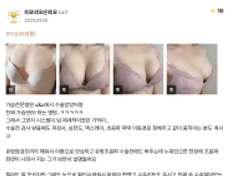 모티바 가격? 작년 모티바 사용량 1위 병원에서 알려드리겠습니다. — 본문 이미지 2