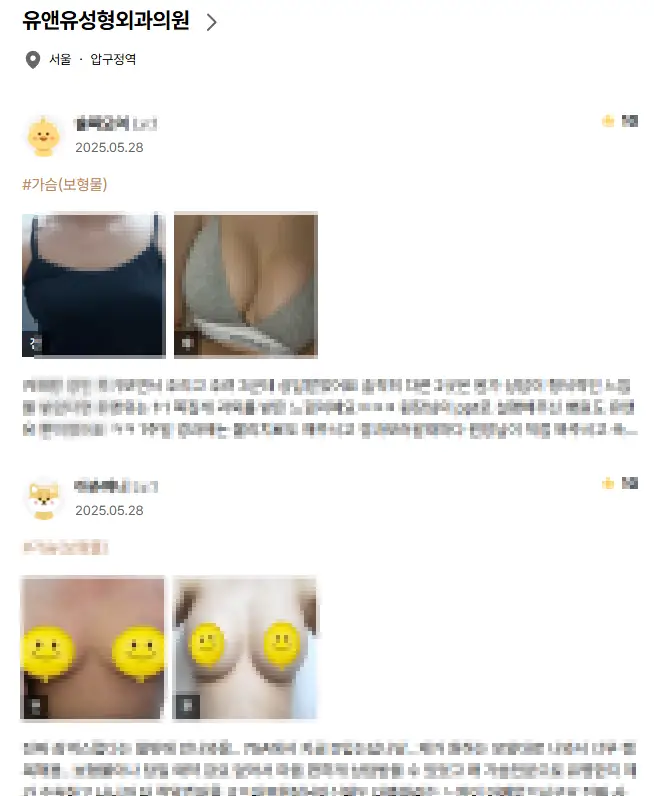 가슴구형구축? 80%가 모르는 잠재 원인 1가지 <논문 첨부> — 본문 이미지 10