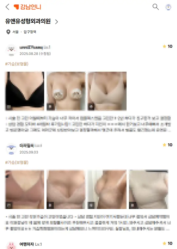 강남언니이벤트, 가슴성형? 과연 믿어도 될까 <2789건의 논문을 바탕으로 드리는 조언> — 본문 이미지 2