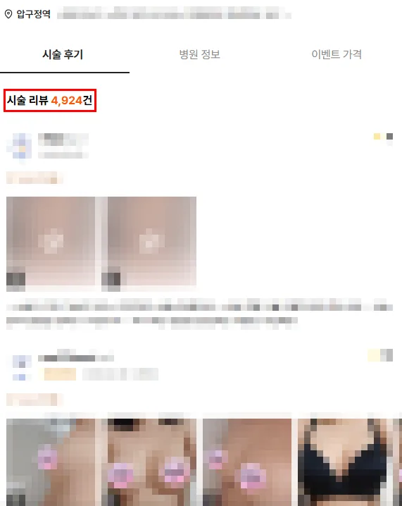 인천가슴성형, 서울까지 거리가 망설여질 때 2가지 살펴보세요<20년의 연구 경험으로 드리는 조언> — 본문 이미지 2