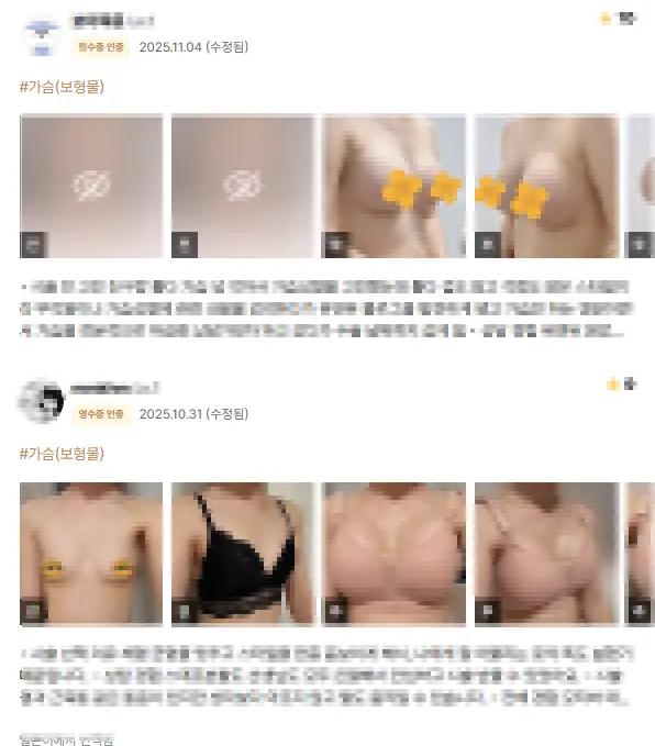 압구정가슴성형외과, 수술 원장 후기만 보고 방문하면 된다는 착각 — 본문 이미지 3