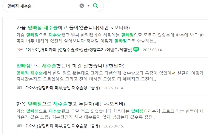 가슴확대수술비용 400~1000만원대? 대체 뭐가 맞는 걸까 < 20년 연구경험으로 드리는 조언 > — 본문 이미지 7