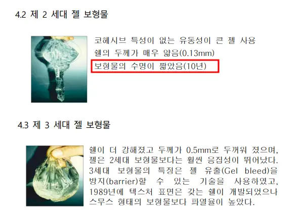 가슴수술10년, 보형물 교체? 20년의 경험을 바탕으로 조언 드립니다. — 본문 이미지 8