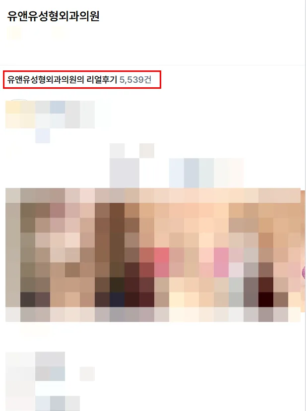 처진가슴성형, 보형물 넣으면 더 처지지 않을까 걱정되는 분께 드리는 2가지 조언 — 본문 이미지 3