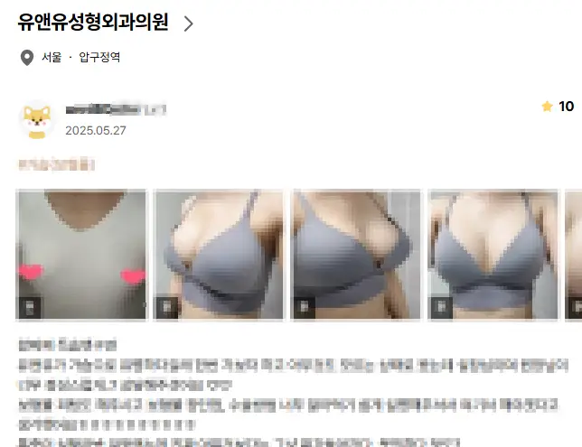 가슴재수술시기? 사이즈불만족 / 부작용 등 상황에 따라 알려드립니다. <20년의 연구 경험으로 드리는 조언 > — 본문 이미지 1