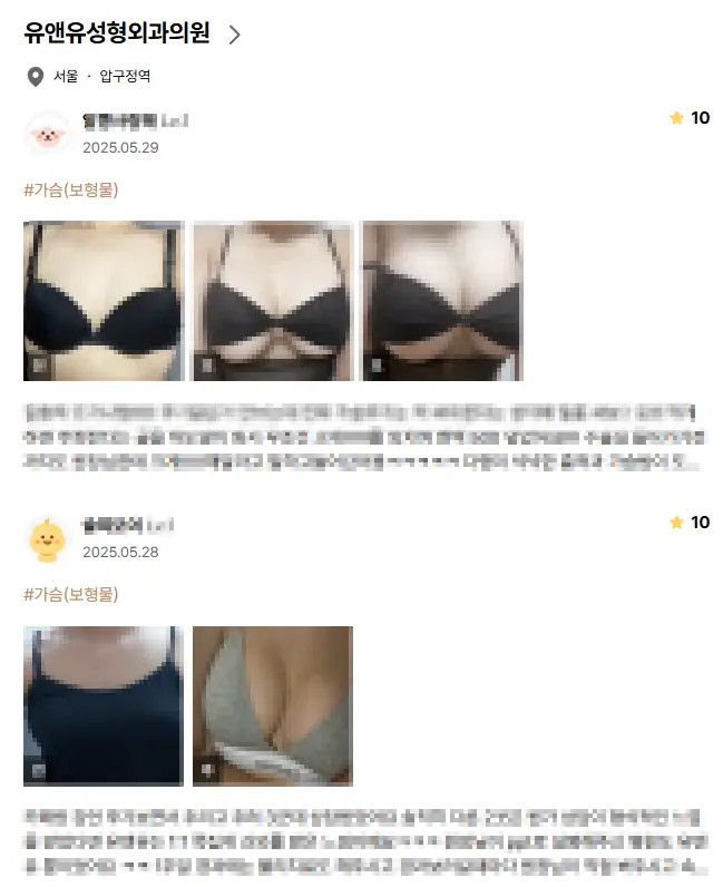 20여년 전부터 가슴성형만을 연구해온 기록들