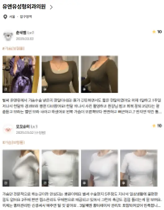 가슴축소술, 사이즈별 절개 방법까지 20년의 연구 경험으로 알려드립니다. — 본문 이미지 10