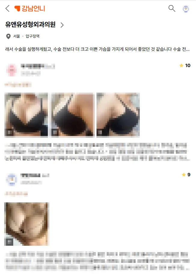 가슴수술후처짐, 보형물도 들어갔는데 더 심해지지 않을까? — 본문 이미지 2