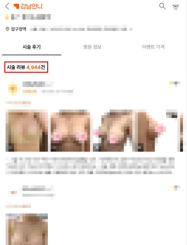 모티바멘토, 안정성/촉감 차이점 총 정리해드립니다 <20년 가슴성형만을 연구한 곳 작성> — 본문 이미지 2
