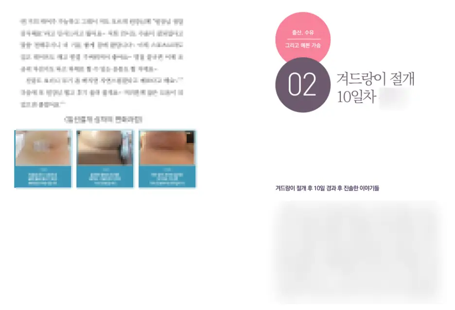 유방확대술비용? 1가지가 수십 수백만원을 결정합니다. <20년의 연구 경험으로 드리는 조언> — 본문 이미지 5