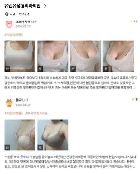 모티바 촉감, 탱탱/말랑/단단? 왜 후기마다 얘기가 다를까. — 본문 이미지 10