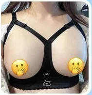 보정브라만 착용한 가슴성형 직후 모습