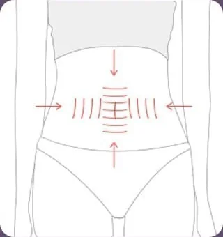 늘어진 피부 절제 후 가로세로 이중 복근 성형을 표시한 도해