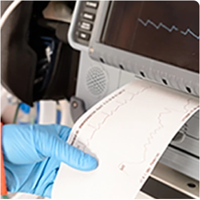 심전도 검사 기록지
