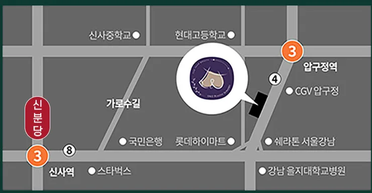 유앤유성형외과 약도 — 압구정역 4번 출구 도보 5분, 가로수길 인근