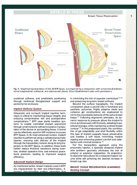 Clinics in Plastic Surgery 게재 논문 본문 — 3D BTP Space 도해