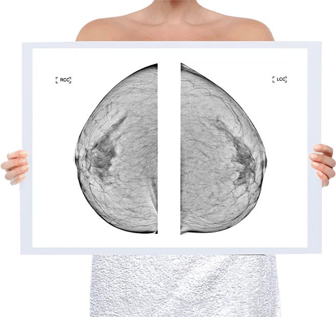 Healthy Breast 맘모그래피 img5 m